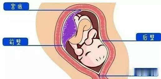 前壁和后壁順產(chǎn)疼痛對比，深度解析產(chǎn)程疼痛感受，前壁與后壁順產(chǎn)疼痛對比，深度探討產(chǎn)程疼痛感受的差異性