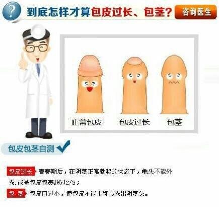 為什么當兵要割包皮，探討割包皮與軍事生活的關聯(lián)，探討割包皮與軍事生活的關聯(lián)，為何當兵需要割包皮？